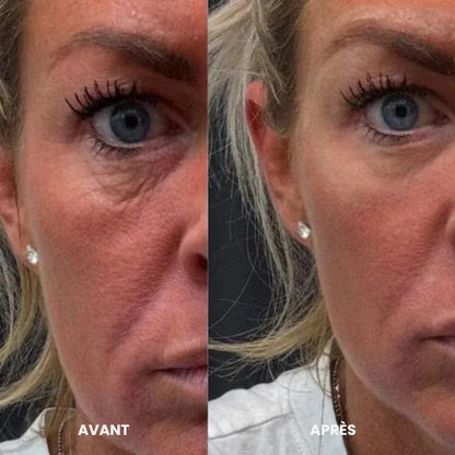 Patchs pour les yeux à base de peptides et de collagène