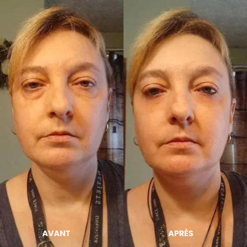 Patchs pour les yeux à base de peptides et de collagène