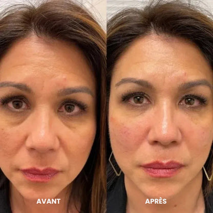 Patchs pour les yeux à base de peptides et de collagène
