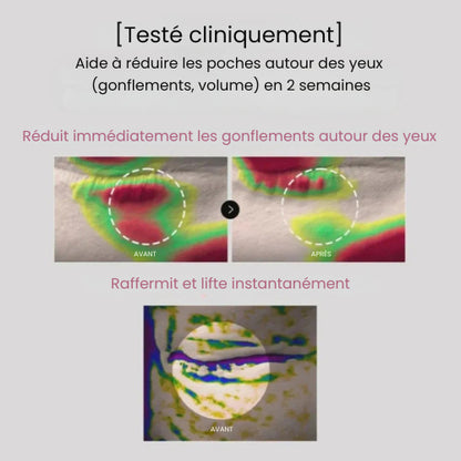 Patchs pour les yeux à base de peptides et de collagène