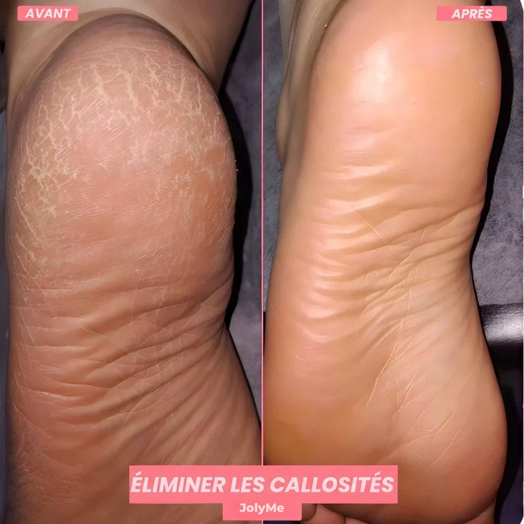 FootGlow™ - Râpe pour pieds