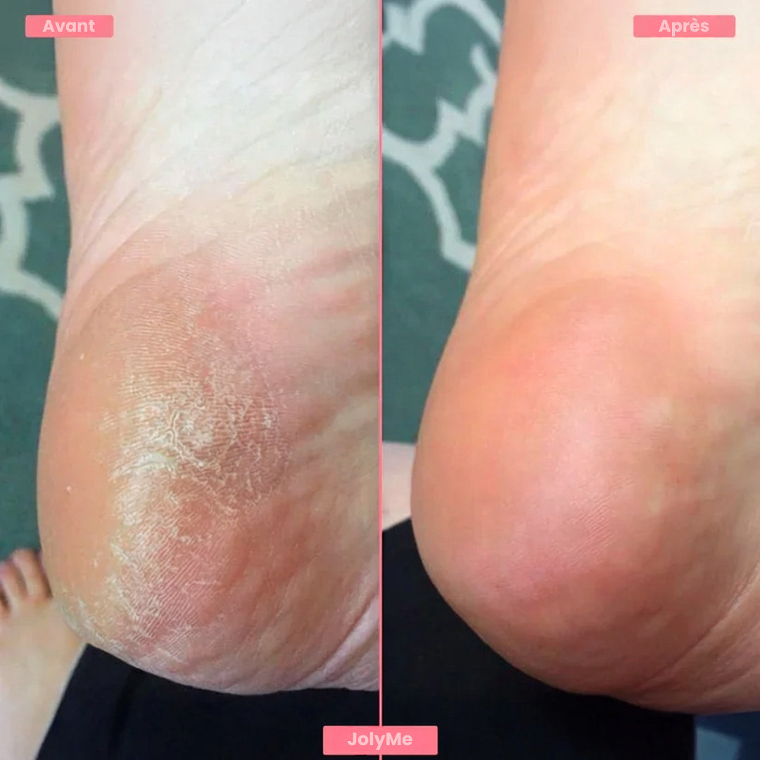 FootGlow™ - Râpe pour pieds