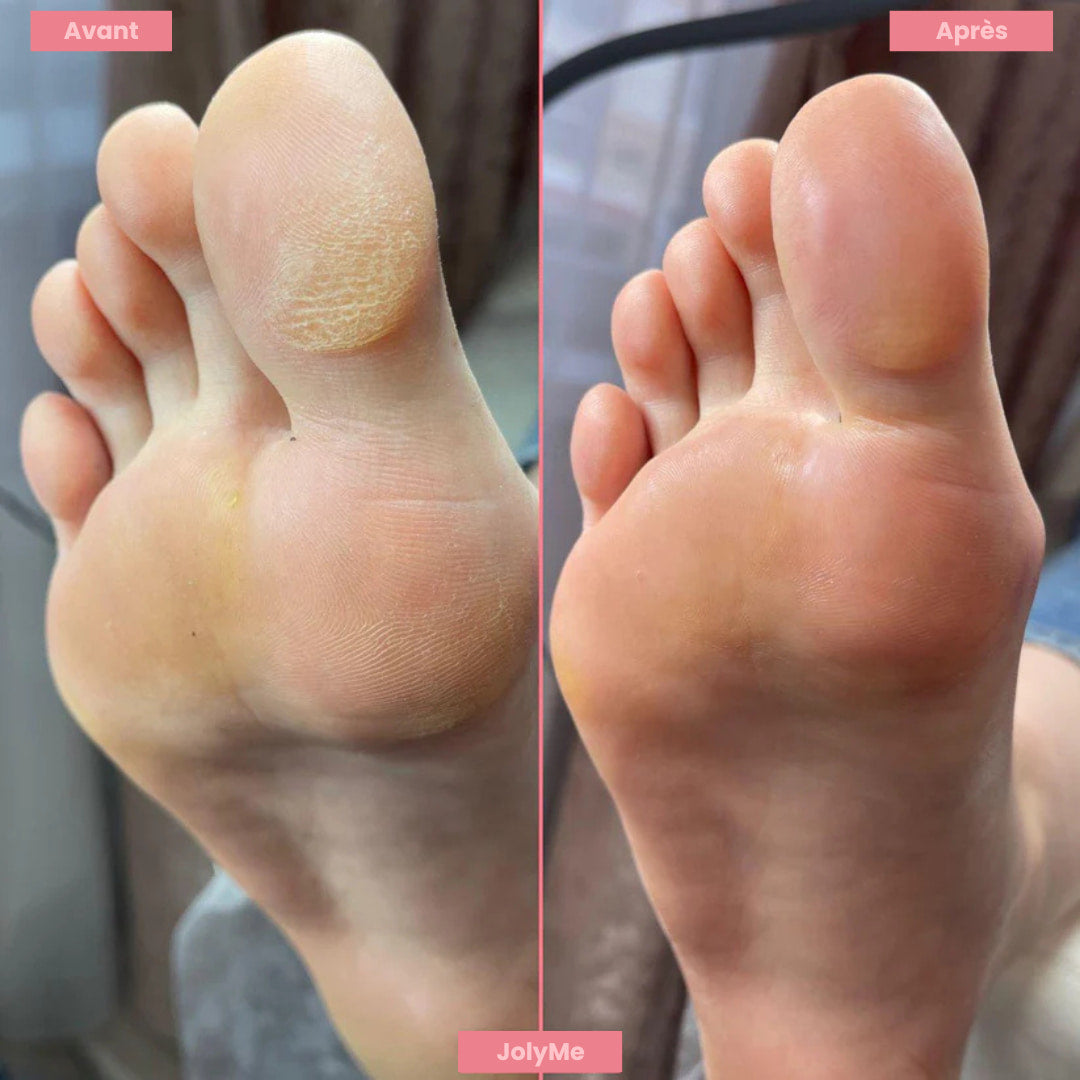 FootGlow™ - Râpe pour pieds