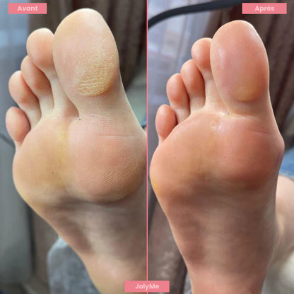 FootGlow™ - Râpe pour pieds