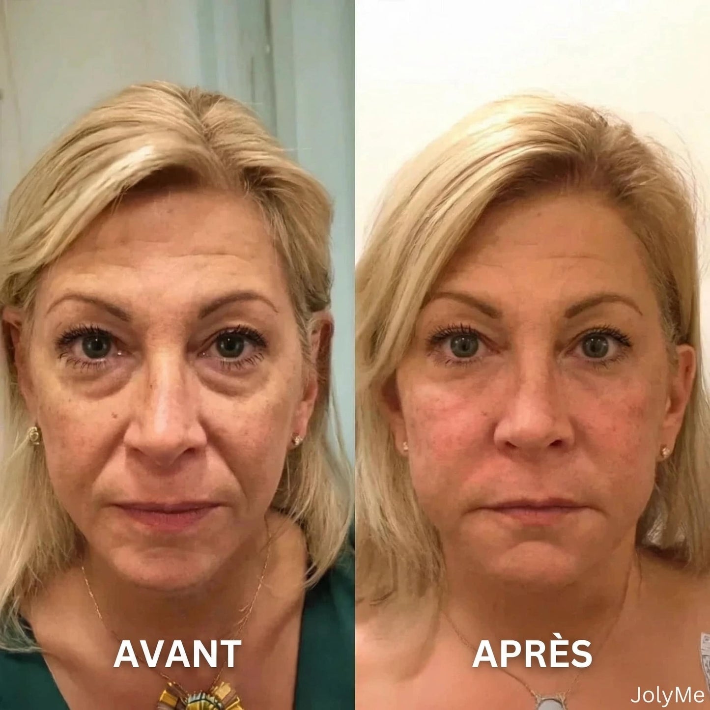 Crème Yeux V-Lift Instantanée