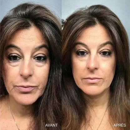 Crème Yeux V-Lift Instantanée