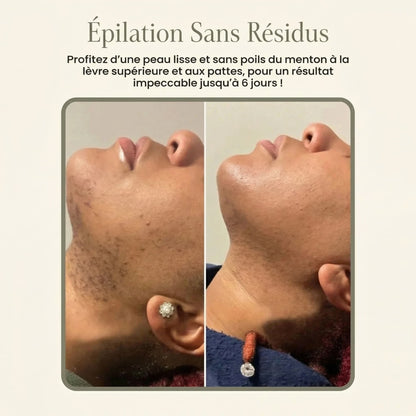 Crème dépilatoire visage & Sérum apaisant