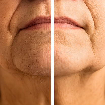 GlowFace™ – Épilateur Facial 2-en-1